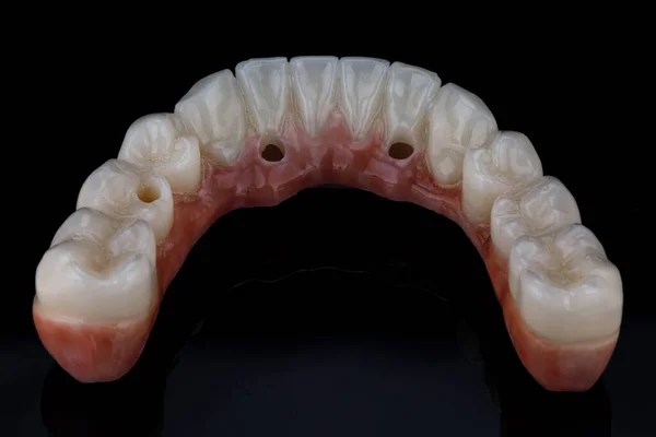 Tooth Morphology Dental Lower Ceramics Ceramic Jaws Black Glass — Fotografia de Stock