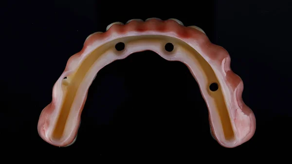 Hole Titanium Beam Dental Protester Lower Jaw Top View Black — ストック写真