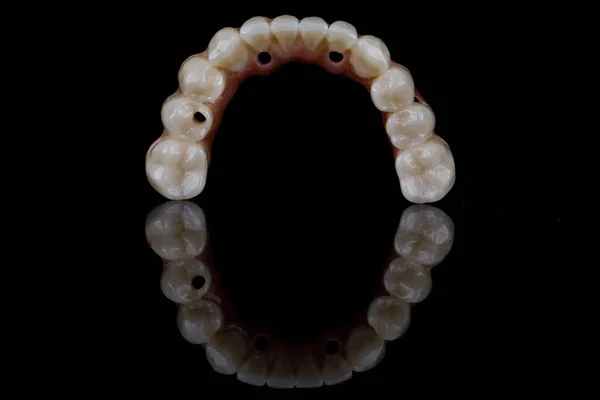 Creative Composition Ceramic Prosthesis Beautiful Morphology Teeth Black Background Reflection — Fotografia de Stock