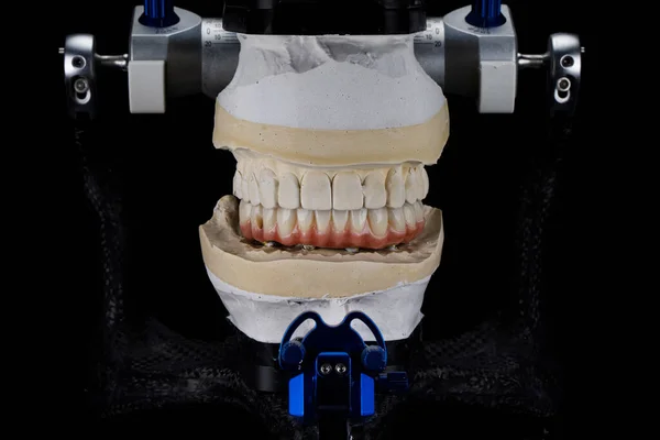 Dental Articulator Ceramic Prosthesis Model Plaster Bite Black — Stok fotoğraf