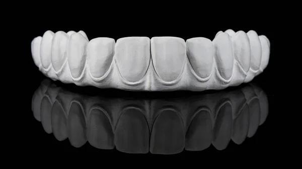 Milled Dental Prosthesis Upper Jaw Pure Zircon Black Glass Reflection — Foto de Stock