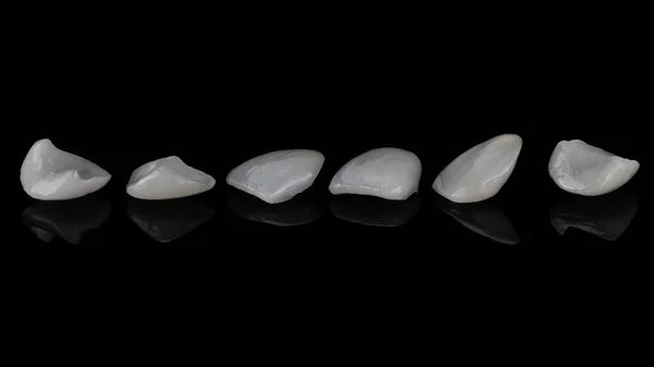 Beautifully Laid Out Ceramic Veneers Central Teeth Black Glass — Zdjęcie stockowe