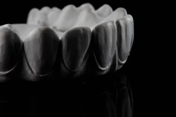 Creative Dental Photo Relief Zircon Prosthesis Black Background — Fotografia de Stock