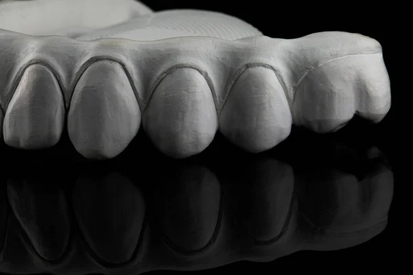 Creative Dental Photo View Chewing Teeth Zircon Prosthesis Black Background — Stock fotografie