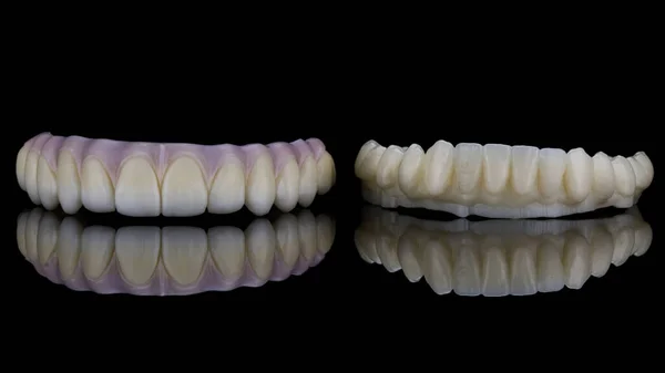 Dental Prosthesis Zircon Plastic Prosthesis Black Glass Reflection — Stok fotoğraf
