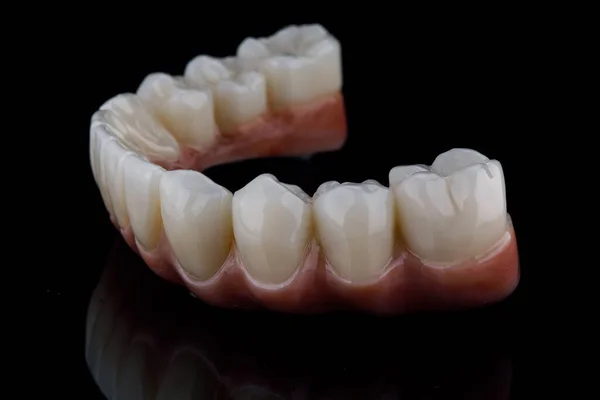 Dental Prosthesis Ceramics Lower Jaw Side View Black Background —  Fotos de Stock