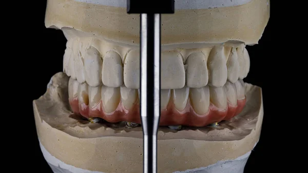 Lower Jaw Prosthesis Made Ceramics Models Occlusion Articulator — ストック写真