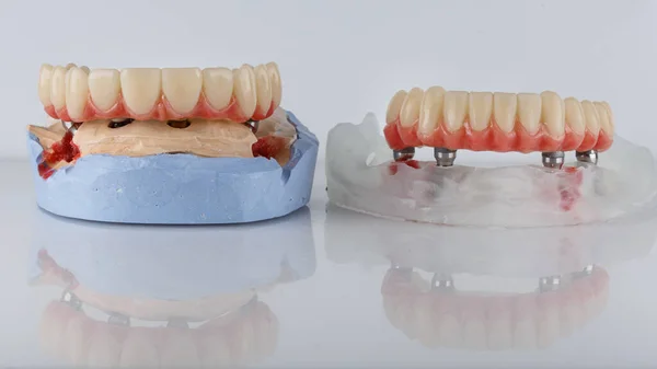 Two Dental Prostheses Artificial Gums White Background — Foto de Stock