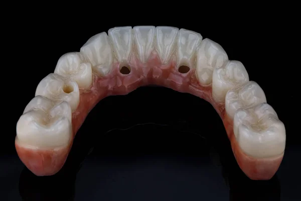 Tooth Morphology Dental Lower Ceramics Ceramic Jaws Black Glass Fotos de stock libres de derechos