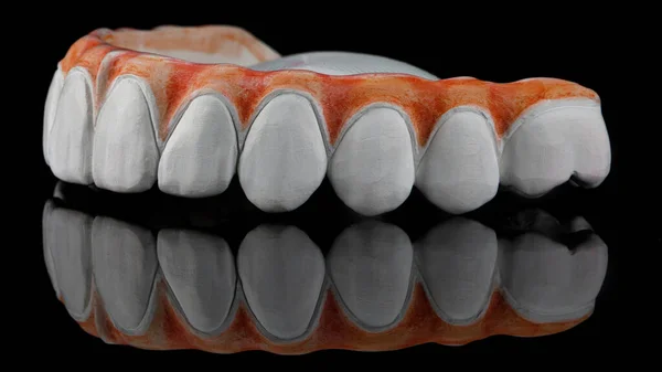 Dental Prosthesis Made Zircon Colored Gum Applying Ceramics Black Glass Imagen de archivo