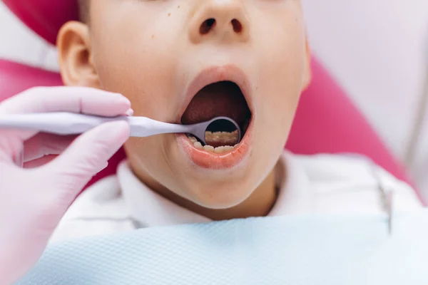 女性歯科医は男の子の口の歯科検査を行います — ストック写真