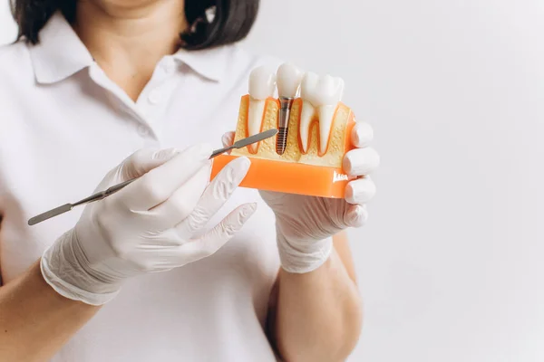 Glad Tandläkare Läkare Kvinna Visar Mockup Implantat — Stockfoto