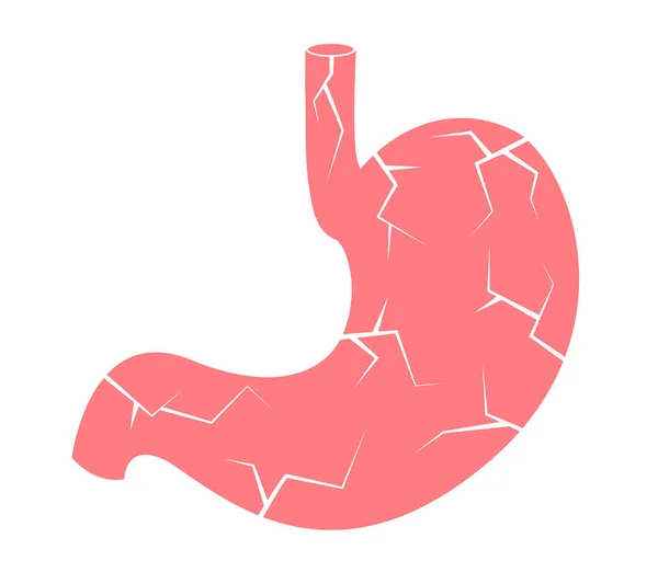 Damage Stomach Unhealthy Stomach Health Care Concept Vector Illustration — Vector de stock