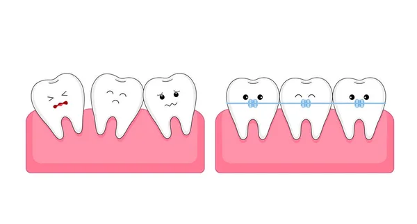 Carino Personaggio Dei Denti Dei Cartoni Animati Con Tutore Concetto — Vettoriale Stock