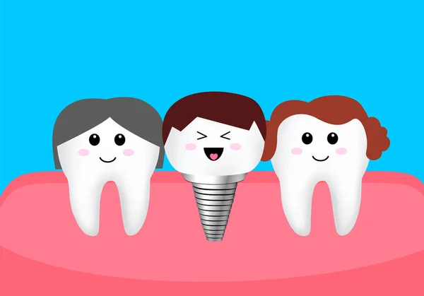 Cartoon Tooth Character Dental Implant Dental Care Concept Tooth Implant — Stockový vektor