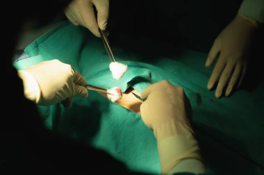 Ameliyat odasında kasten pamuk yumağı ve neşter tutarken çalışan iki cerrahın elleri bilgi ve deneyim gerektiren bir ameliyat..