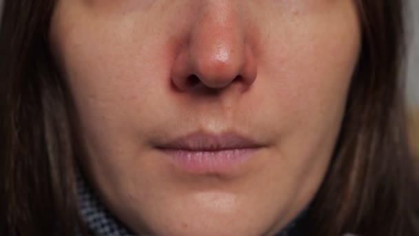 Woman with nose reddened from illness snots in napkin macro — Stock Video