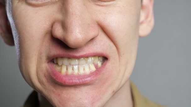 Homem mostra dentes com restos de comida — Vídeo de Stock