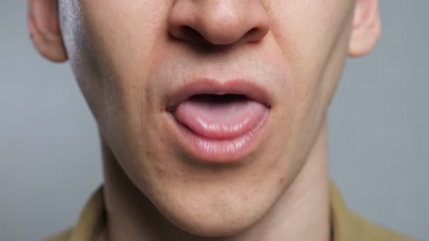 Homem irreconhecível mostra infecção língua — Vídeo de Stock