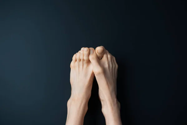 Gros Plan Des Pieds Féminins Sur Fond Noir Mur — Photo