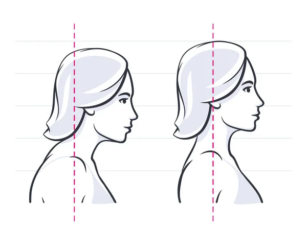 Correction de la posture position du cou illustration vectorielle de posture correcte — Image vectorielle