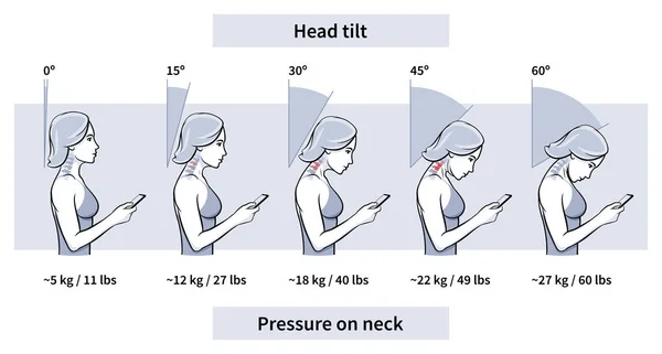 Carga pressão pescoço cabeça inclinação ângulo vetor ilustração — Vetor de Stock