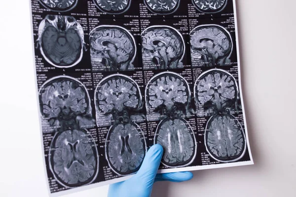 Beyaz bir arkaplanda MRI görüntüsü. Eldivenli doktorlar bir enstantane tutuyor.