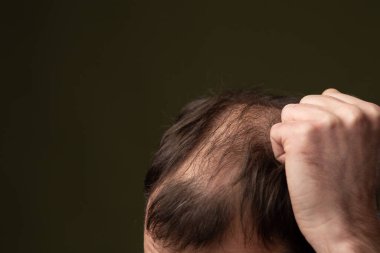 Kel bir adam koyu bir arka planda yakın planda..