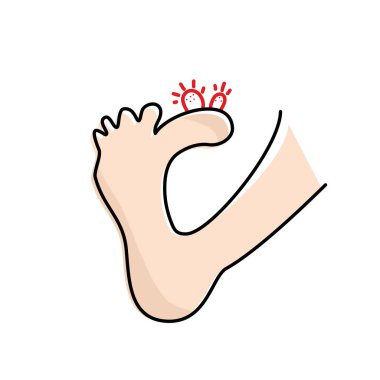 Plantar wart icon. Verruca symbol, foot corn, human papillomavirus sign, HPV infection, clavus pictogram, feet papilloma vector illustration