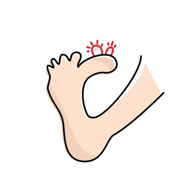 Plantar wart icon. Verruca symbol, foot corn, human papillomavirus sign, HPV infection, clavus pictogram, feet papilloma vector illustration clipart
