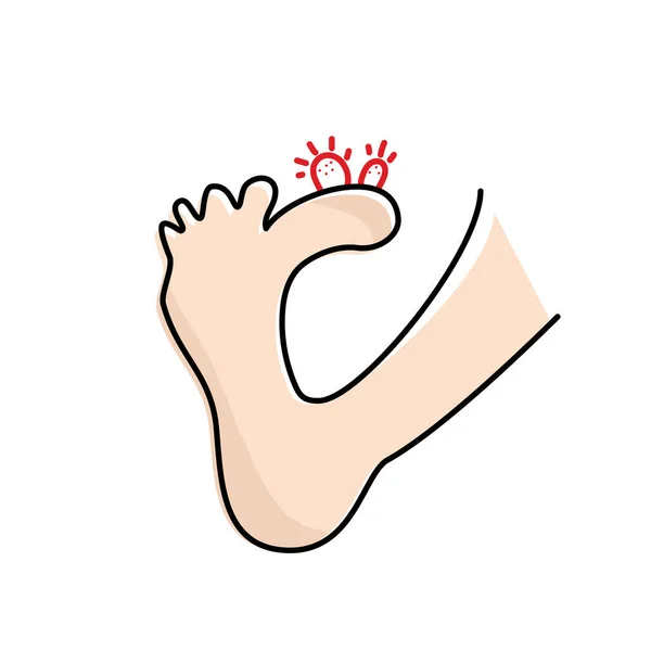 Plantar Wart Icon Verruca Symbol Foot Corn Human Papillomavirus Sign — Stockový vektor