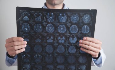 Doktor kafasının röntgenine bakıyor..