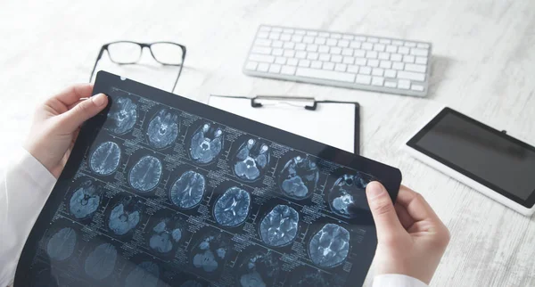Läkare Tittar Röntgenbild Huvudet — Stockfoto