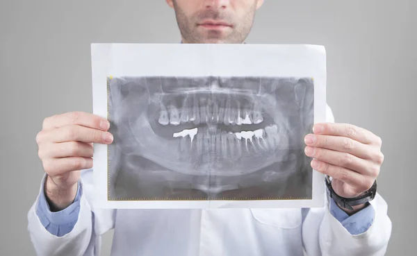 歯で保持している白人医師X線画像 — ストック写真
