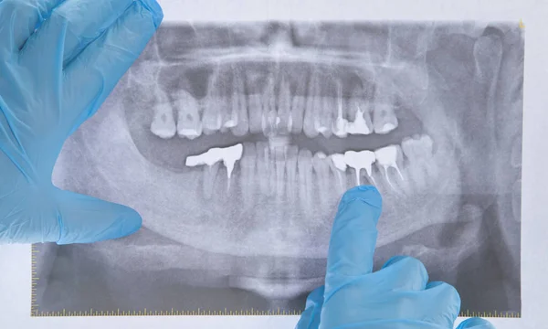 歯で保持している白人医師X線画像 — ストック写真