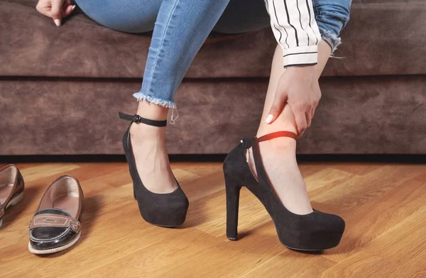 Young Woman Feeling Ache Because Wearing High Heels — Stock Photo, Image