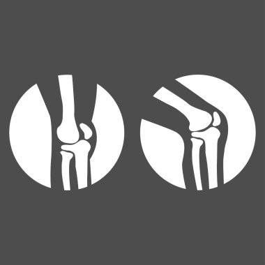 İnsan diz eklemli yan görüş vektör çizimi izole edilmiş kavram