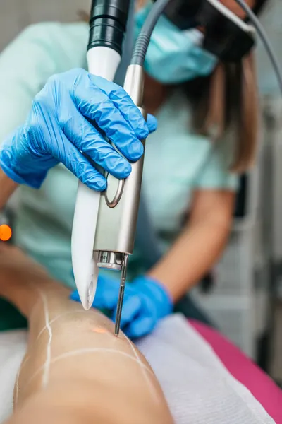 Mulher Jovem Recebendo Depilação Laser Tratamento Permanente Remoção Pêlos Corpo — Fotografia de Stock