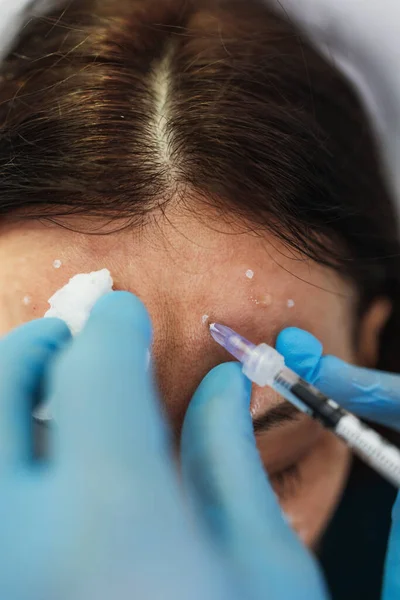 Una Mujer Atractiva Está Recibiendo Inyecciones Faciales Rejuvenecedoras Clínica Belleza — Foto de Stock