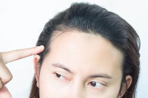 Женщина Серьезная Проблема Выпадения Волос Здоровья Шампуня Косметики Концепция Продукта — стоковое фото