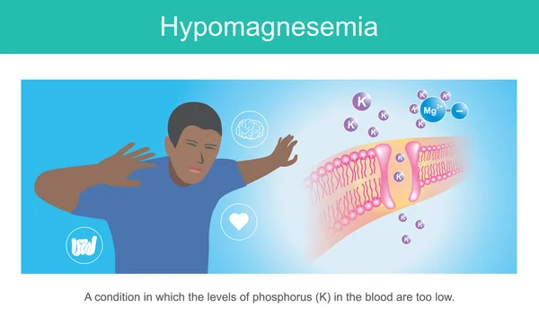 Hypomagnesemia Illustration Showing Symptomsa Man Condition Which Levels Phosphorus Blood — Stock Vector