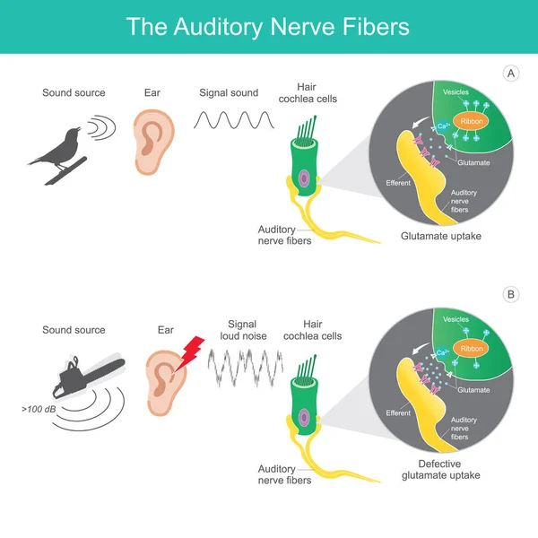 Las Fibras Nerviosas Auditivas Comparando Los Tipos Fuente Sonora Que — Vector de stock