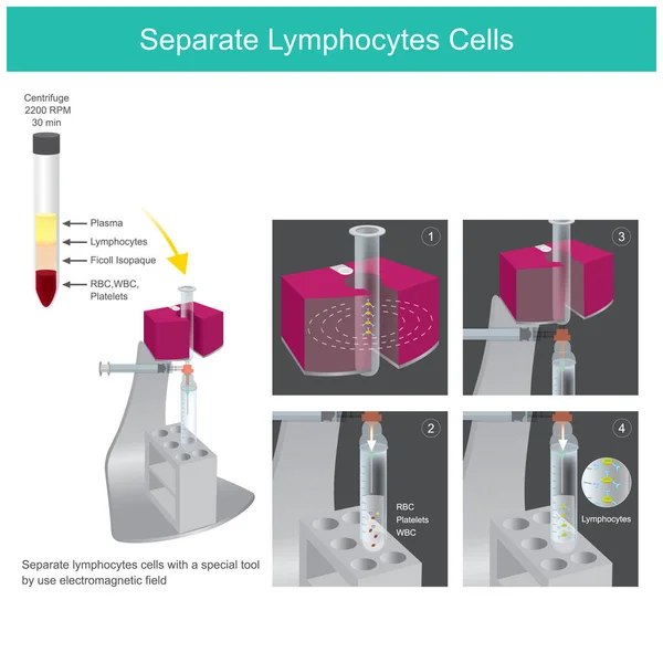 Separate Lymphocytes Cells Illustration Sample Officer Worked Medical Laboratory Use — Stock Vector