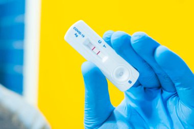 COVID-19 için Hızlı Test Kullanılarak Pozitif Test Sonuçları