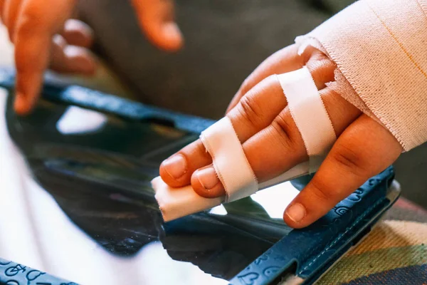 Hand of a child with splinted fingers