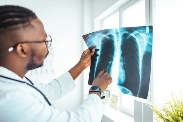 Male radiologist analyzing chest X-ray of an patient at medical clinic during coronavirus epidemic. Doctor with radiological chest x-ray film for medical diagnosis on patient\'s health on asthma, lung disease and bone cancer illness