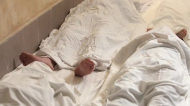 Doğuştan hastalıkları olan insanların covid-19 hastalığına yakalanma riski daha yüksektir. Cesede yakın çekim