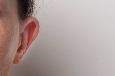 Hafif bir arka planda öne doğru bakan dişi patisi. Ottoplasty, kulaklığın plastiği..