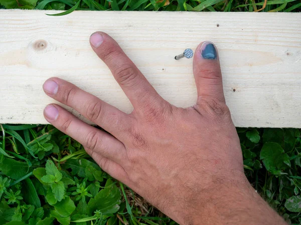 親指のクローズアップは 爪の近くに打たれたボードに打撃を与えた 仕事中の怪我 トップビュー フラットレイアウト — ストック写真