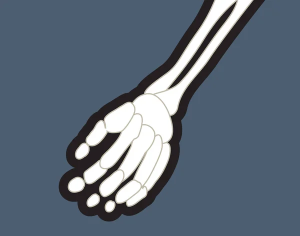 Human Hand Skeleton Bone Illustration —  Vetores de Stock